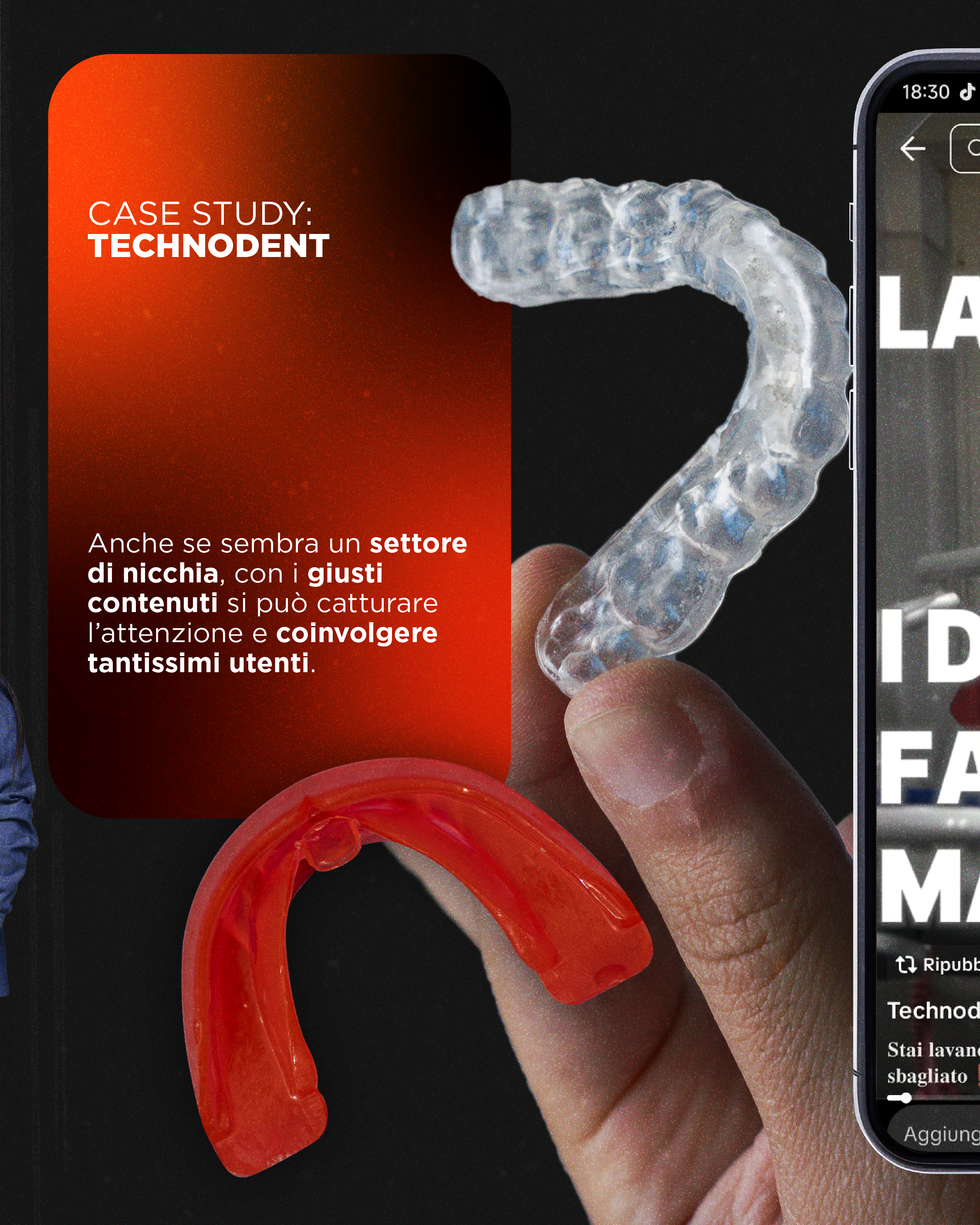 Technodent detail
